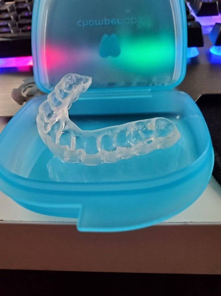 The Hybrid Night Guard - for moderate to heavy teeth grinding and clenching - Customer Photo From Todd LaBell