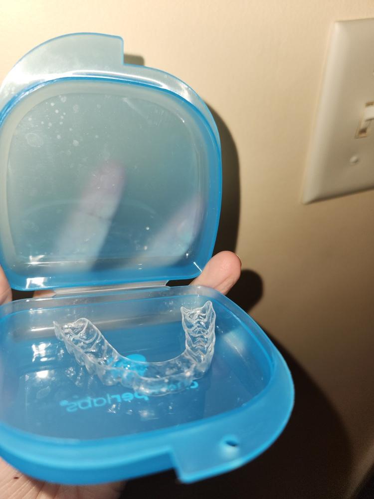 The Retainer - for teeth retention and teeth grinding - Customer Photo From Svetlana Reina