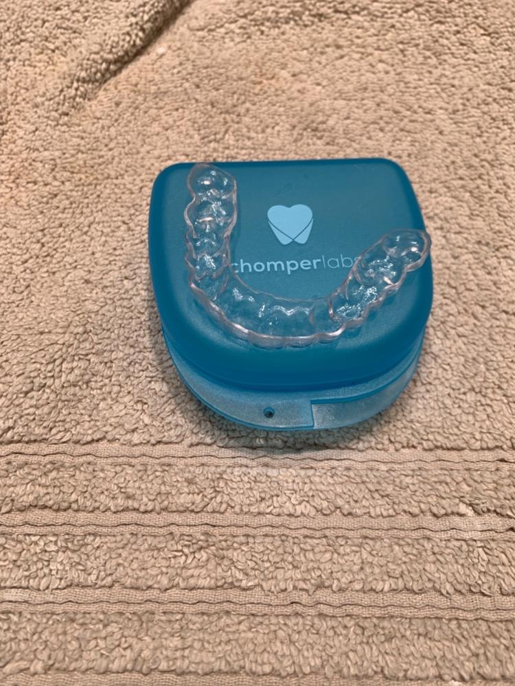 The Retainer - for teeth retention and teeth grinding - Customer Photo From Daniel Verb