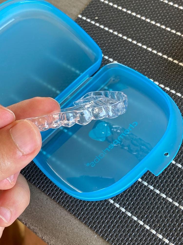 The Retainer - for teeth retention and teeth grinding - Customer Photo From Stefano Anania