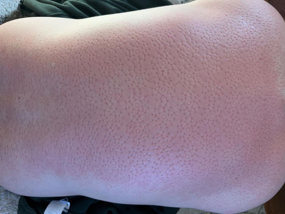 Shakti Premium Acupressure Mat - Customer Photo From Sandra Rojo