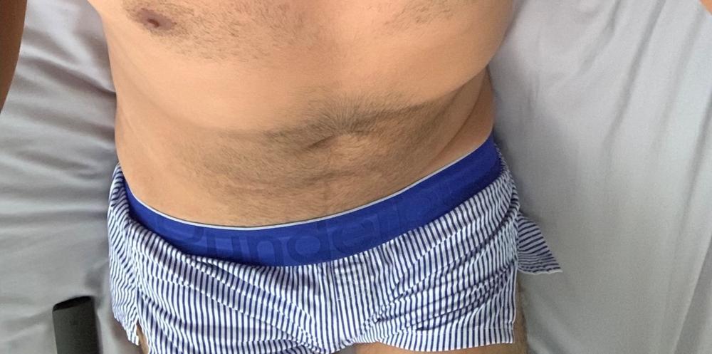 Basic Lift Boxer - Customer Photo From Bequer Raya