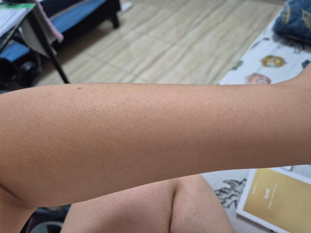 Lumi - Permanent Hair Removal Device - Customer Photo From Michelle ben boaz