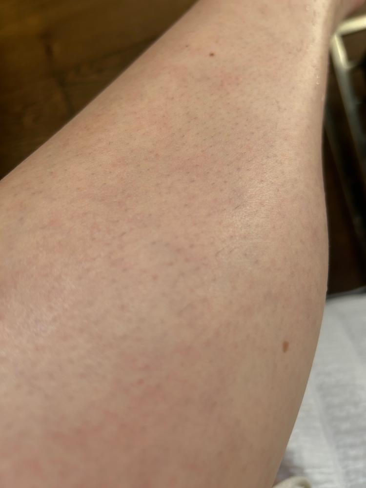 Silky Smooth Routine (Lumi + 2 Gloves + Lotion) - Customer Photo From Kaitlin 