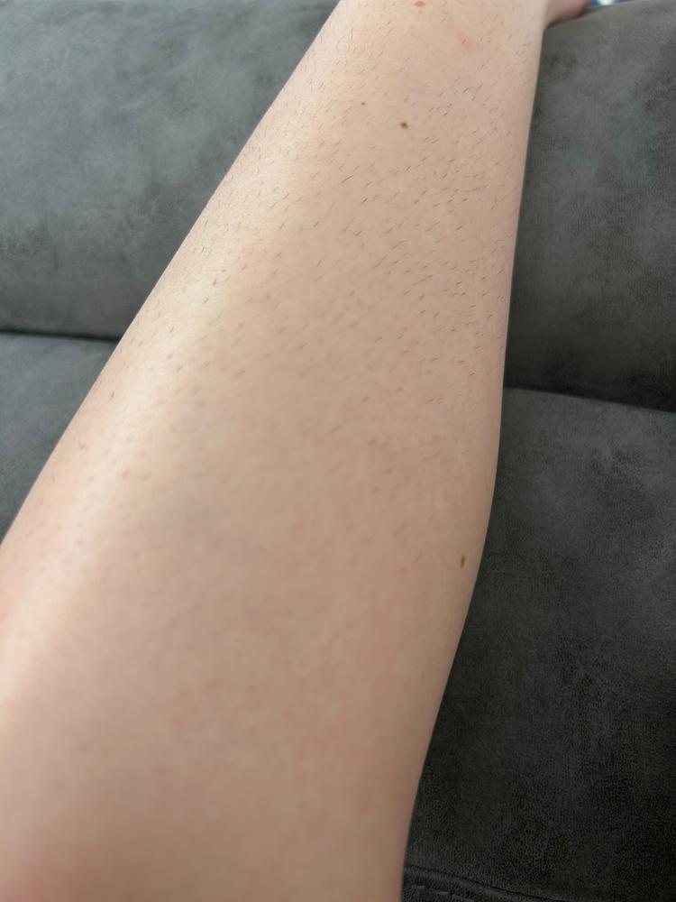 Silky Smooth Routine (Lumi + 2 Gloves + Lotion) - Customer Photo From Kaitlin 