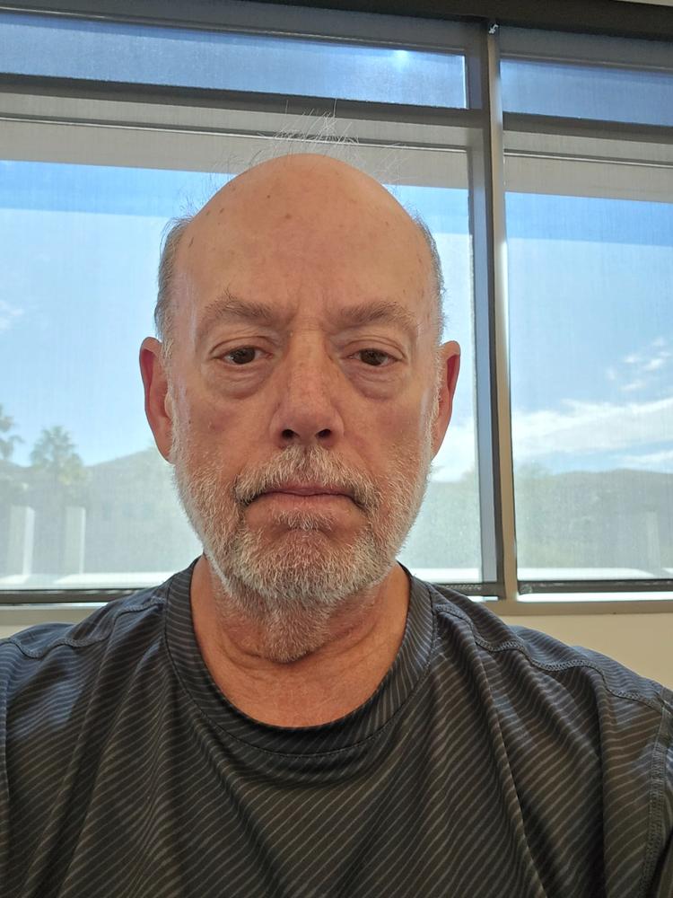 Monthly Ultimate Anti Aging Routine - Customer Photo From Kevin Hamric