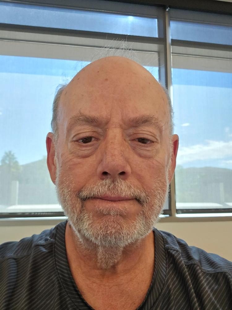 Monthly Ultimate Anti Aging Routine - Customer Photo From Kevin Hamric