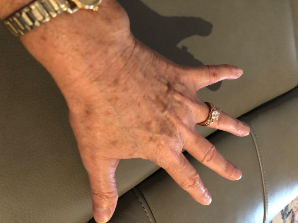 Glycerine Hand Therapy™ 6oz Platinume Gold - Customer Photo From DEBBIE LEWIS