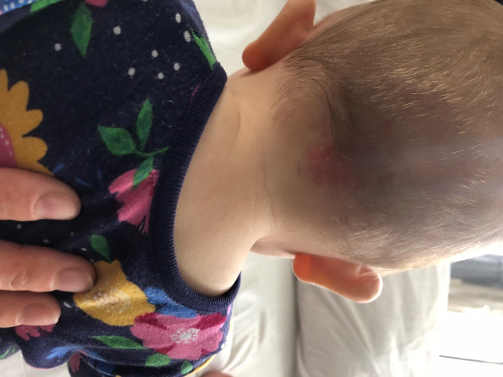 Revitalising Scalp and Body Cream - Customer Photo From Linda Pavlova Štroncerovà