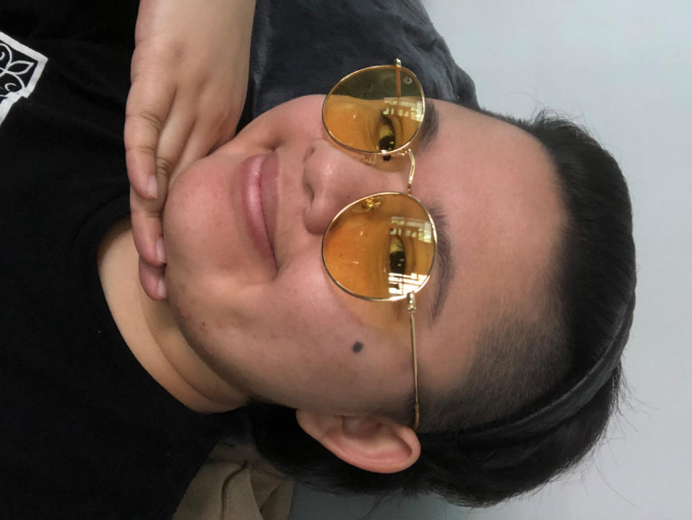 ROUND - YELLOW - Customer Photo From Abi M.