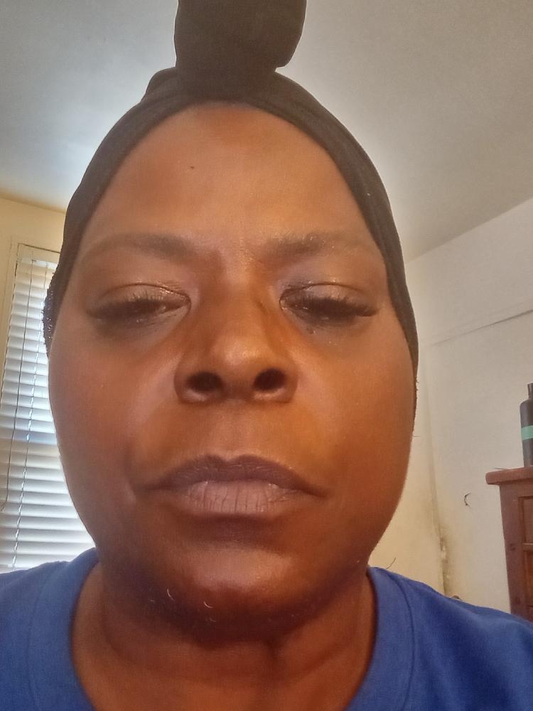 Discoloration Correcting Body Treatment - Customer Photo From Shelley Walker