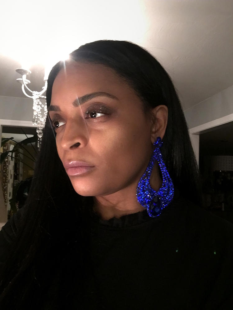 ROSEMARY SCALP TREATMENT - Customer Photo From Dee @iamdchic
