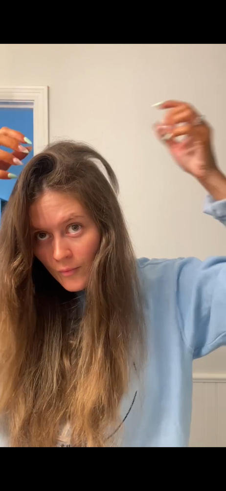 ROSEMARY SCALP TREATMENT - Customer Photo From Hope Kolb