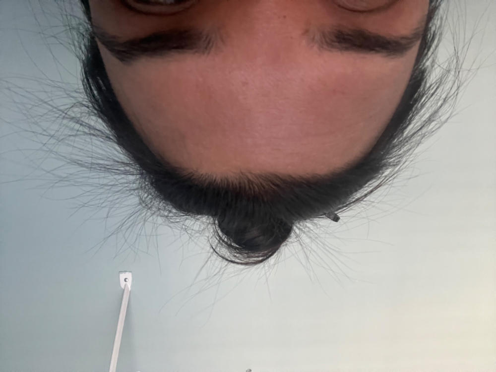 ROSEMARY SCALP TREATMENT - Customer Photo From Neela Fung