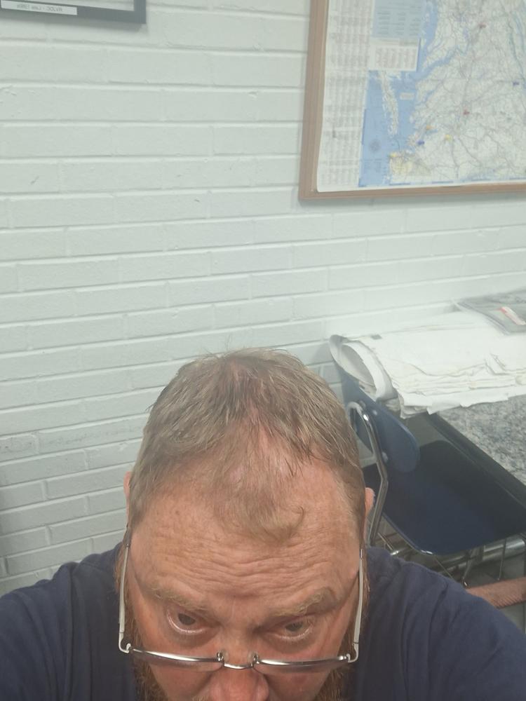 Particle Hair Vitamin Gummies - Customer Photo From joseph crouch 