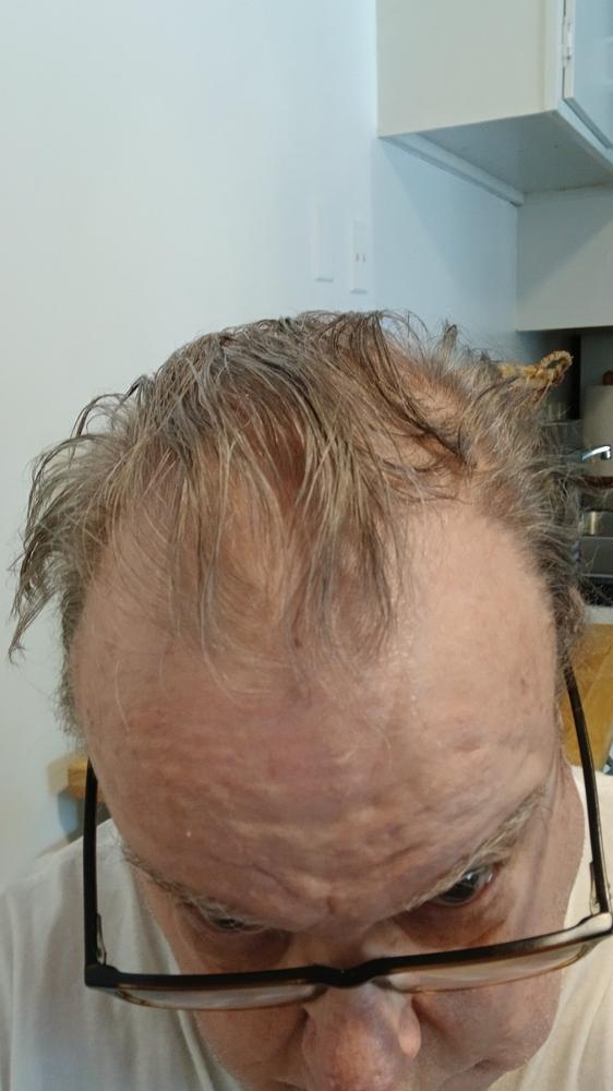 Particle Anti-Gray Serum - Customer Photo From Leon Harmon
