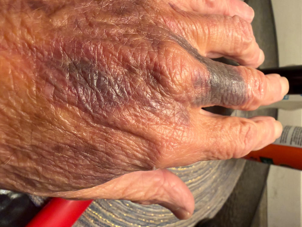 Particle Hand Cream - Customer Photo From Donald Barnes