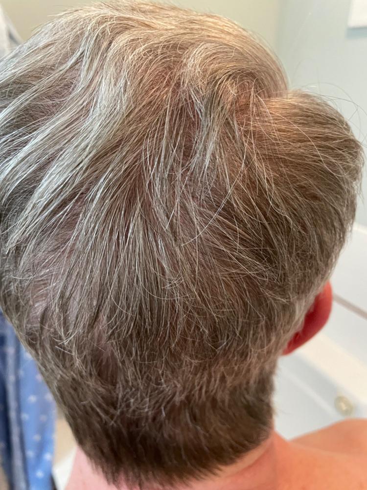 Particle Hair Revival Kit - Customer Photo From Dave Conner