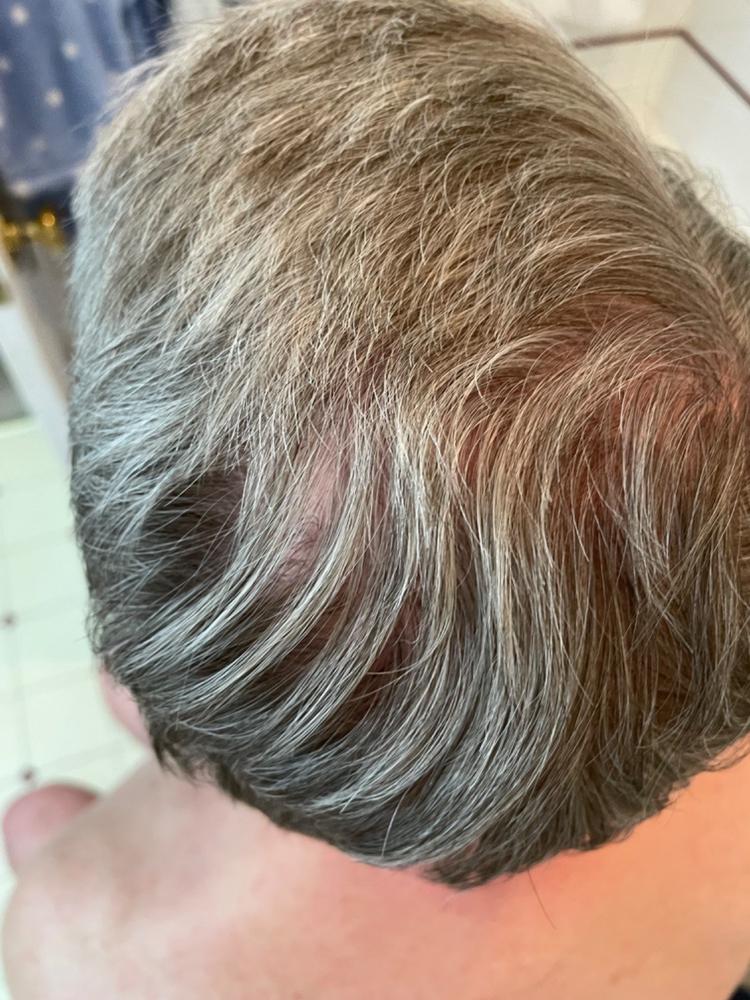 Particle Hair Revival Kit - Customer Photo From Dave Conner
