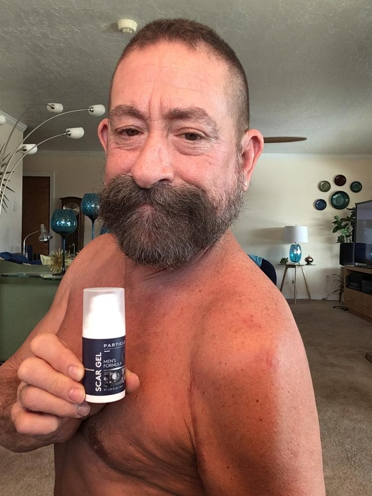 Particle Scar Gel - Customer Photo From Jamie Thigpen