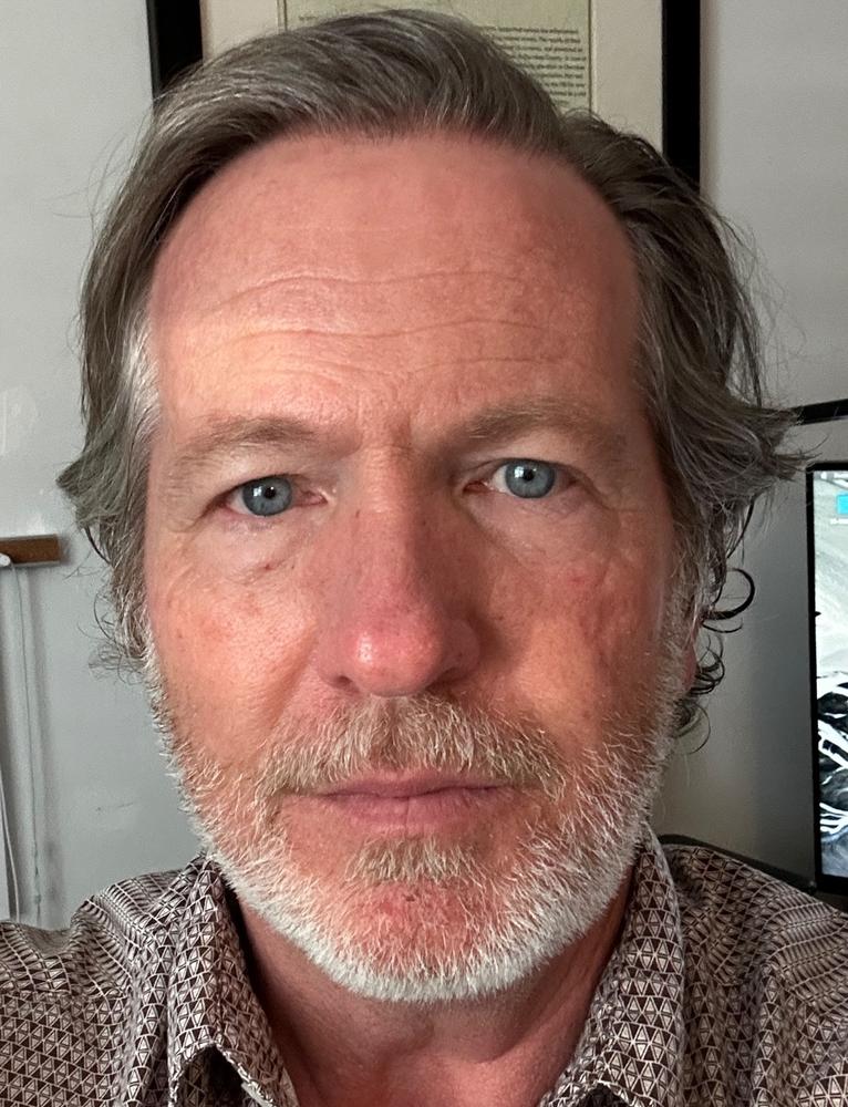 Particle Face Cream - Customer Photo From Johnny Shirley