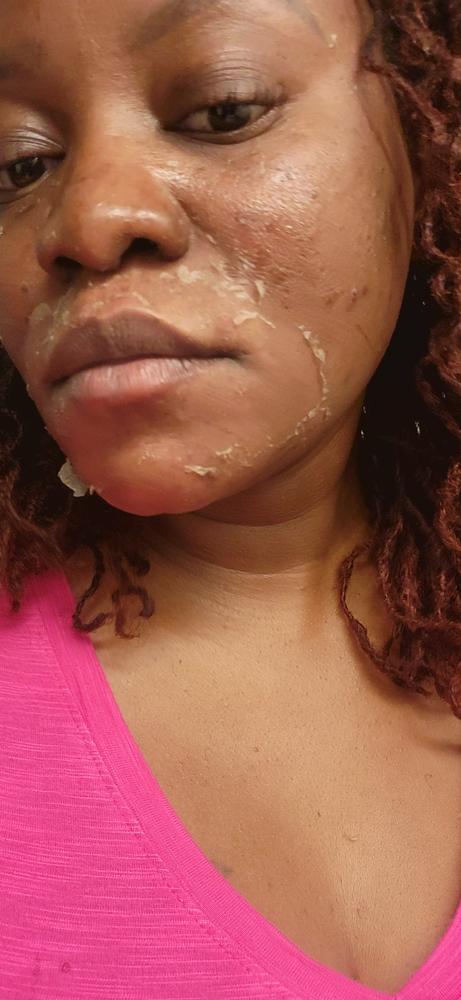 TCA Peel 15% | TCA Peels | makeupartistschoice.com – Makeup