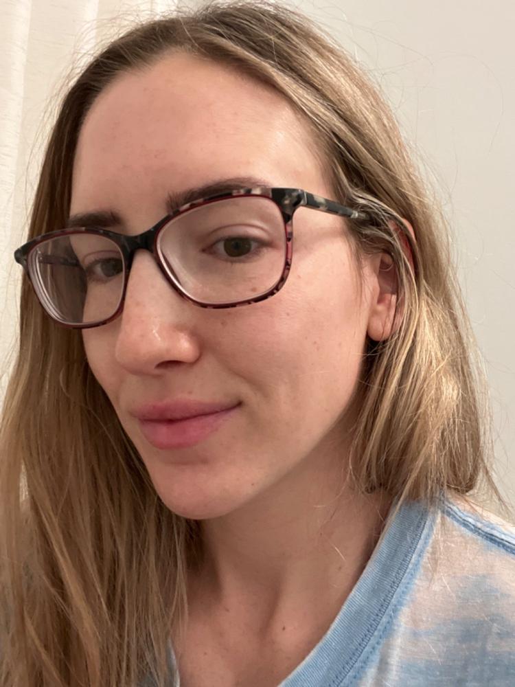 Gly-Luronic Serum | Exfoliate, Hydrate - Customer Photo From Judith H.
