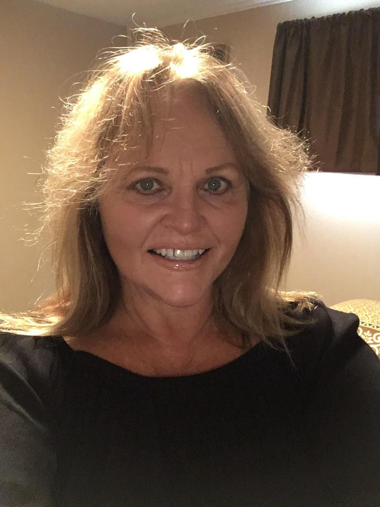 Gly-Luronic Serum - Glycolic Hyaluronic - Customer Photo From Linda Ray
