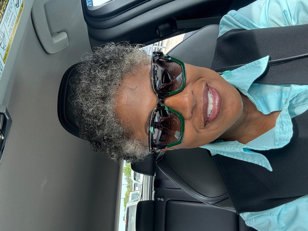 Super C + E Serum for Sun Damaged Skin - Customer Photo From Shirley Williams-Carpenter