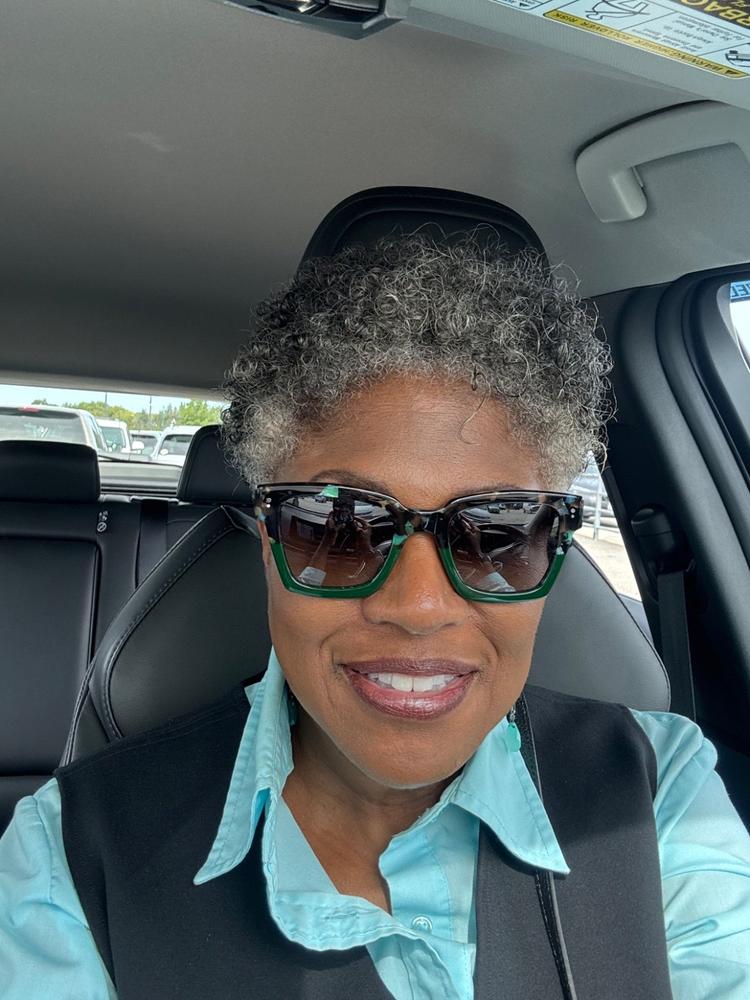 Super C + E Serum for Sun Damaged Skin - Customer Photo From Shirley Williams-Carpenter