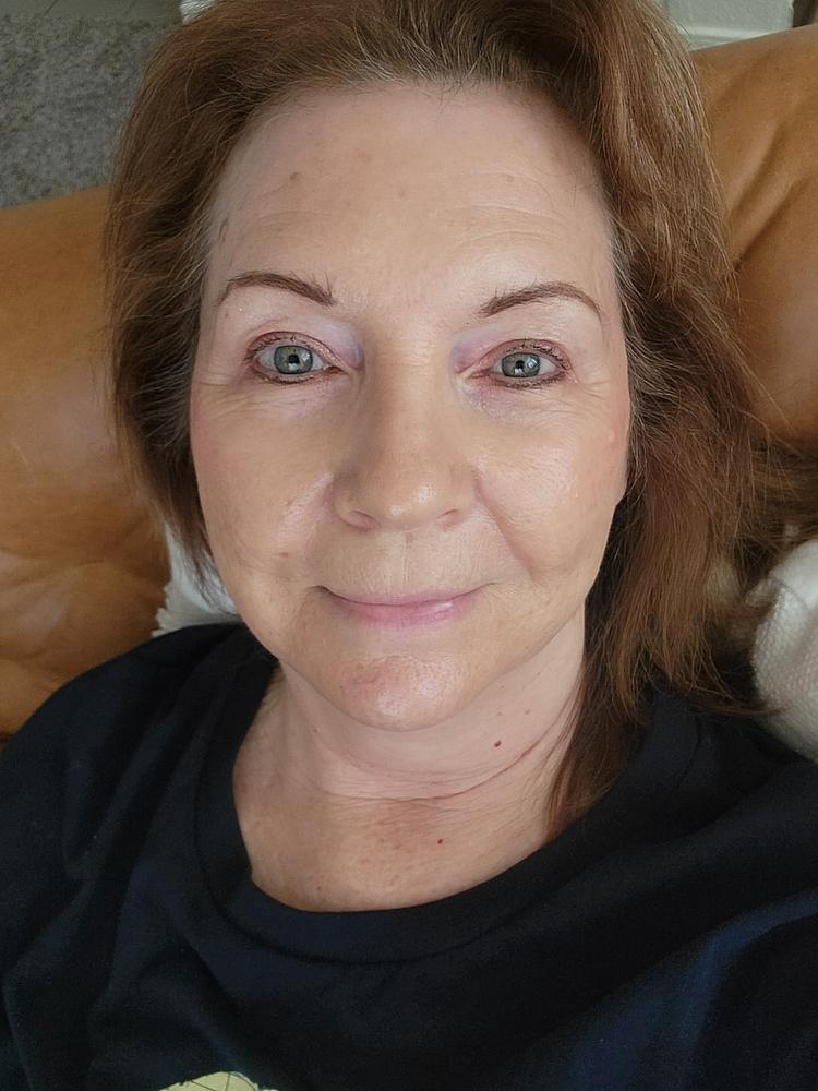 Nano-Hyaluronic - Advanced Hyaluronic Acid Serum w/Watermelon Extract - Customer Photo From Melody Y.