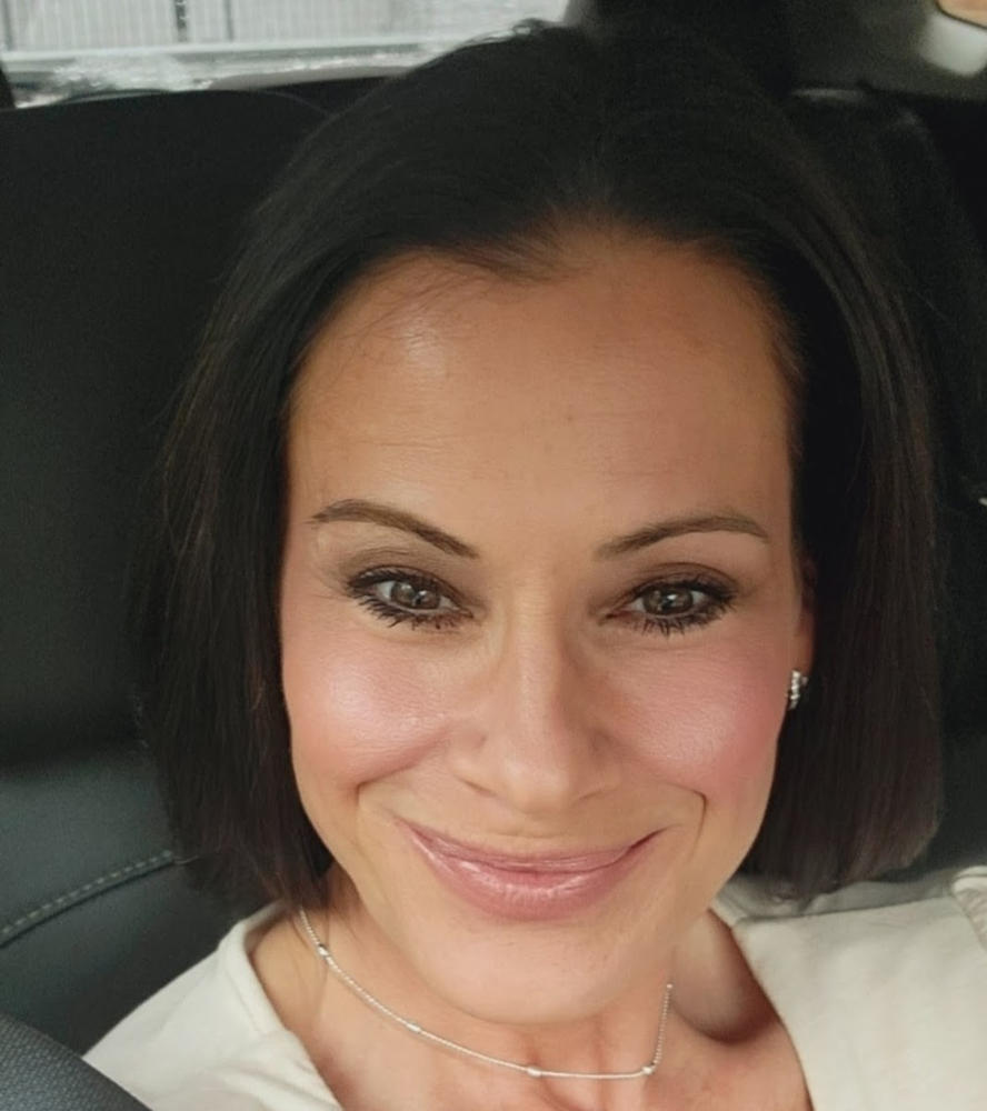 MUAC Advanced Eye Complex - Customer Photo From kiersten diminico