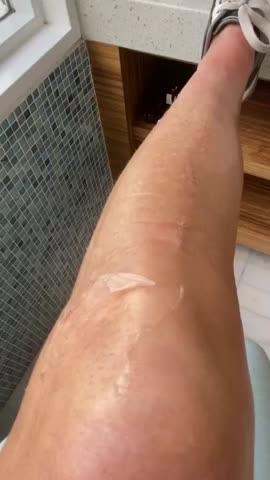 5 Acid Body Peel
