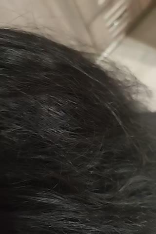 Dandruff Treatment Bundle - Customer Photo From Arshdeep K.