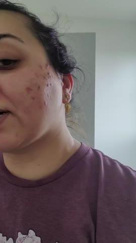 Carrotene IPMP™ Quick Dry Pore Tightening Clay Mask - Customer Photo From Swathi K.
