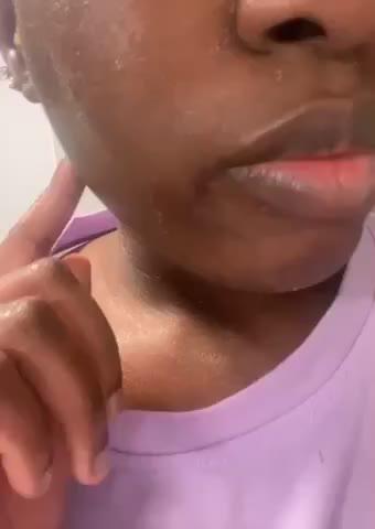 18% TCA At Home Peel - Customer Photo From Rita N.